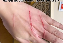 被小猫抓伤了怎么办？（处理小猫抓伤的正确方法及预防措施）