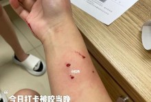 猫咪突然咬人出血了该怎么办？（宠物攻击事故的处理与预防）