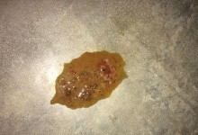 细小病毒侵袭（探索细小病毒引发的拉肚子症状与治疗方法）