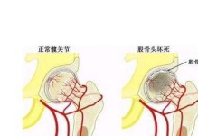 狗狗股骨头切除手术后饮食指南（为宠物提供健康营养，重在调整饮食习惯）