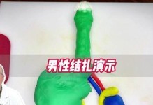 结扎手术后多久可以恢复体力活动？（恢复体力活动的时间及注意事项）