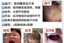小狗缺钙的症状及预防方法（了解小狗缺钙的常见症状，保护你的宠物健康）
