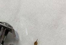 被蜜蜂蛰了怎么处理？（安全、舒缓、预防三部曲教你应对蜜蜂蛰伤）