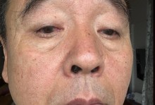 狗狗眼屎多的原因及解决方法（了解狗狗眼屎多的原因，让你的宠物更健康）