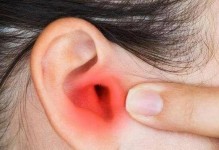 如何正确清理哈士奇的耳道和耳垢（为你的爱宠提供最佳护理，）