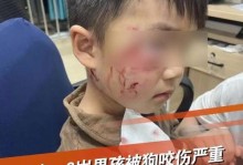 狂犬病发作的狗的症状（了解狗狂犬病发作的常见症状和预防措施）