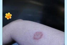 宠物猫咪真菌感染的处理方法（如何保护宠物免受真菌感染？）