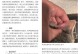 猫藓治疗需要多久？（了解治疗猫藓所需的时间和关键因素。）
