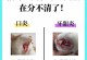 帮助猫咪治疗口炎的3个小技巧（了解口炎症状及治疗方法，给猫咪健康的口腔环境）