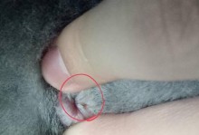 肛门周围的颜色之谜（探索肛门周围颜色变化的原因及其健康暗示）