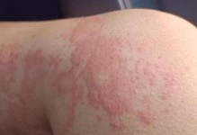 贵宾狗狗为什么老是抓痒却不掉毛？（探究贵宾狗狗的皮肤问题，保持宠物健康）
