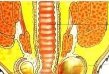 狗狗肛门腺破溃后的正确处理方法（详解清理伤口的关键步骤及注意事项）