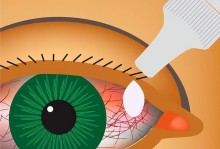 兔子结膜炎的治疗方法及预防措施（安全有效的药物选择与养护技巧）