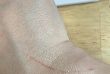 猫咪挠伤后可能出现的症状（了解猫咪挠伤后常见的症状及处理方法）