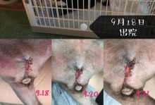 尿道造口术（了解尿道造口手术及其应用领域，提高生活质量）