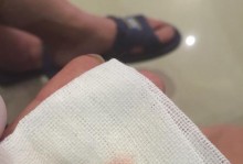 狗狗拔牙后流血多久是正常现象吗？（拔牙后狗狗流血时间长短受哪些因素影响？）